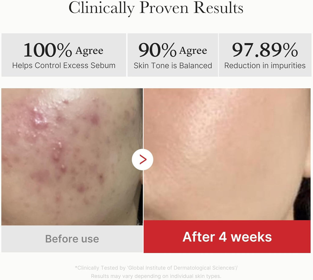 Red Succinic Acid Panthenol Facial Peeling Pads