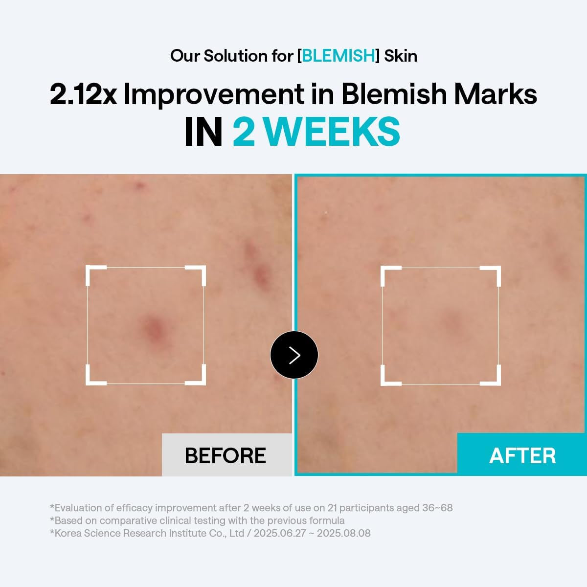 Toner Pads 100 Count - Madecassoside Blemish Care Toner Pad with Centella Asiatica - Improves Uneven Skin Tone & Deep Hydration - Vegan Hypoallergenic Face Gauze, Korean Skin Care