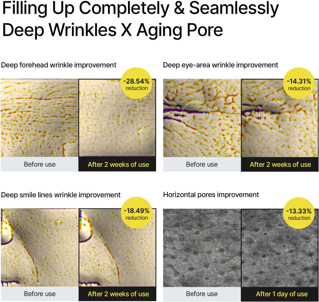 Celimax the Vita a Retinal Shot Tightening Booster | with Retinal 0.1%, Matryxyl 3%, Pore Minimizer, Wrinkles & Fine Lines, Firmer Skin, 15Ml