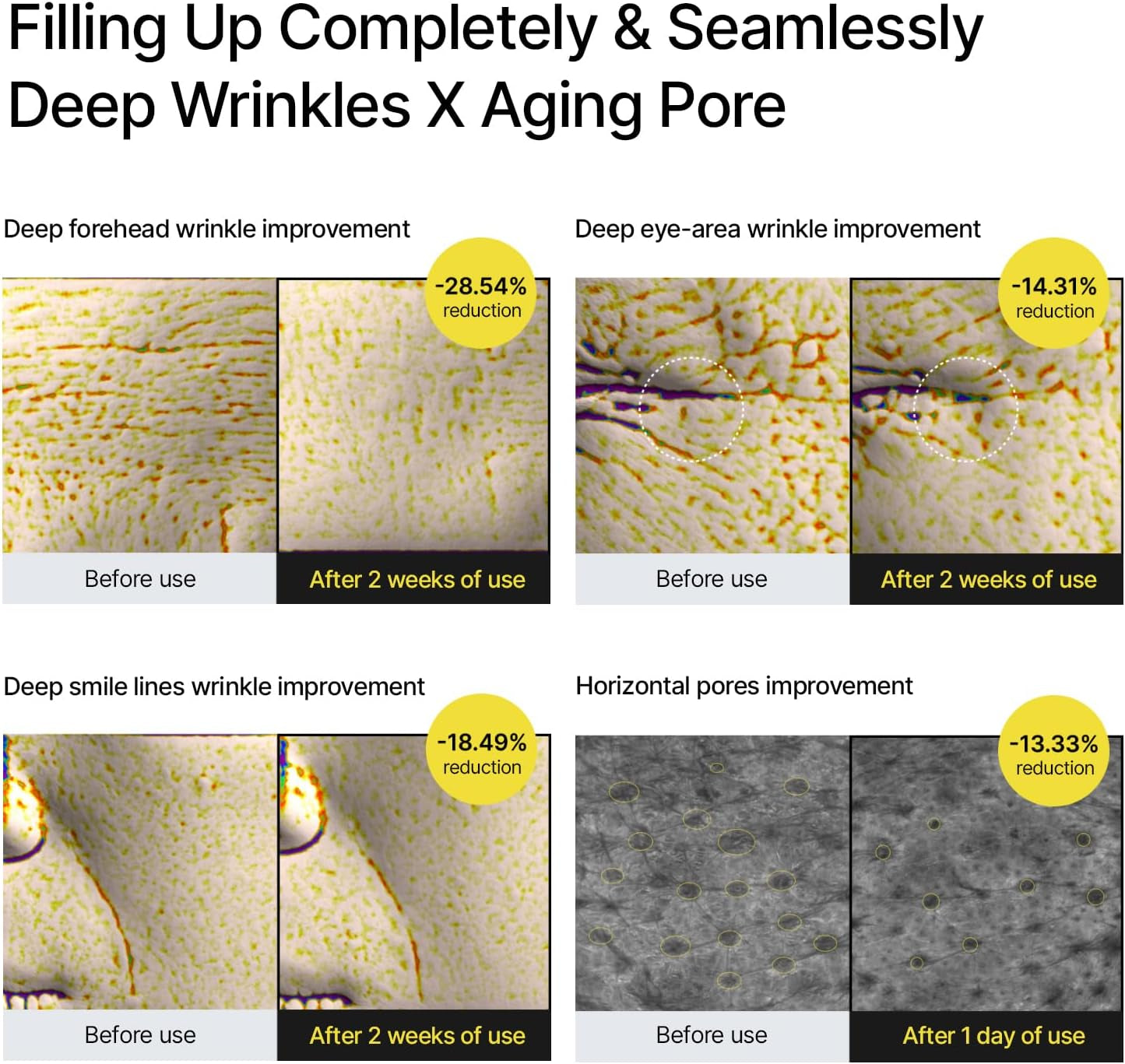 Celimax the Vita a Retinal Shot Tightening Booster | with Retinal 0.1%, Matryxyl 3%, Pore Minimizer, Wrinkles & Fine Lines, Firmer Skin, 15Ml